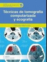 Tecnicas De Tomografia Computerizada Y Ecografia 2ª Ed