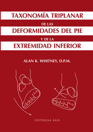 Taxonomía Triplanar De Las Deformidades Del Pie Y De La Extremidad Inferior