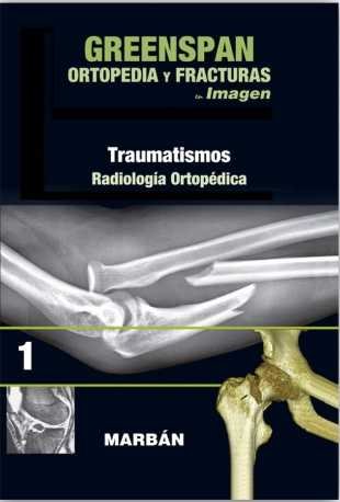 Ortopiedia Y Fracturas Vol.1