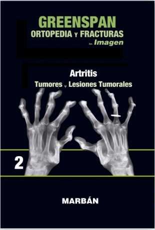 Ortopedia Y Fracturas Vol.2