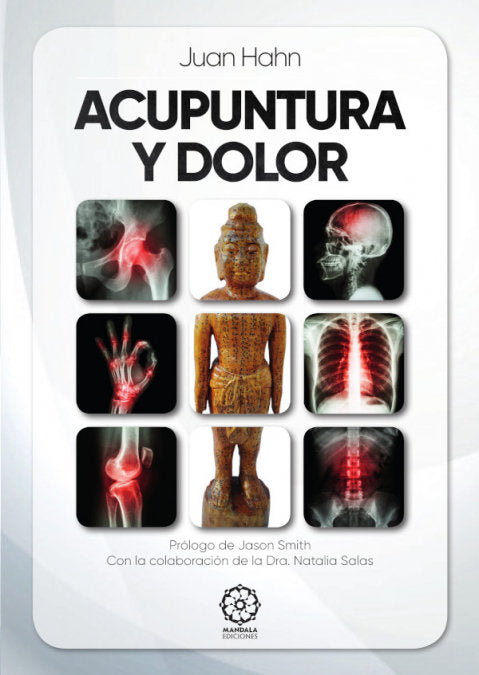 Acupuntura Y Dolor