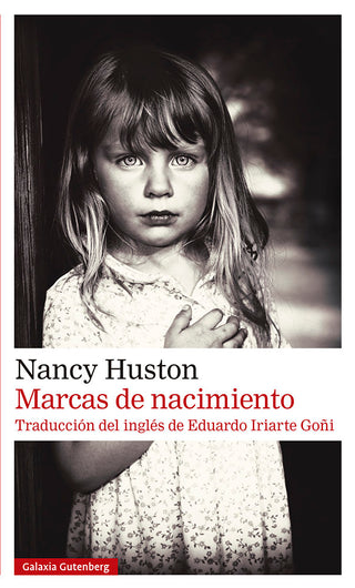 Marcas De Nacimiento