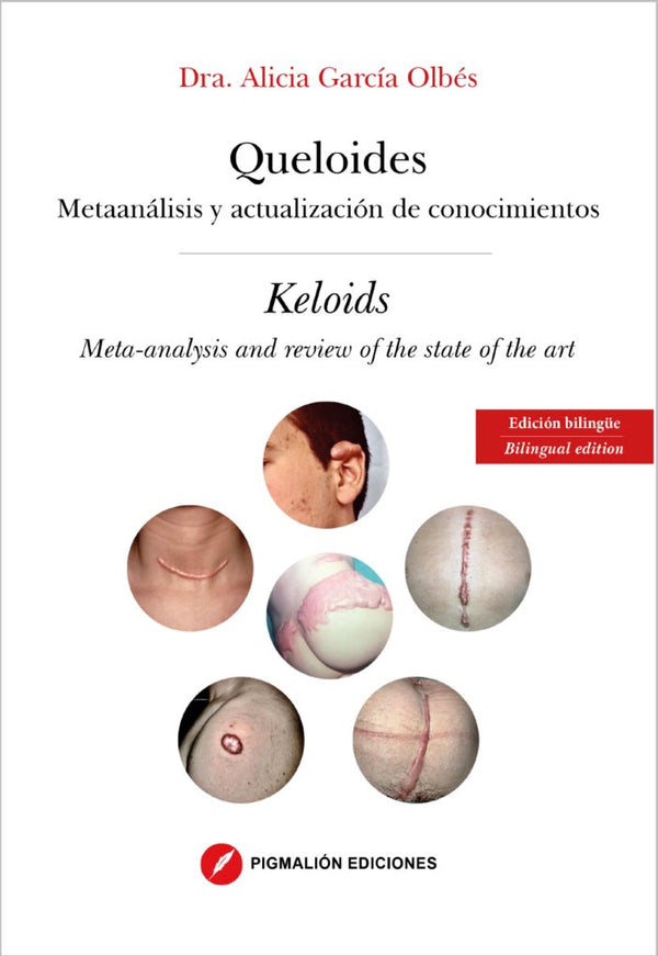 Queloides