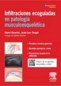 Infiltraciones Ecoagudas En Patología Musculoesquelética