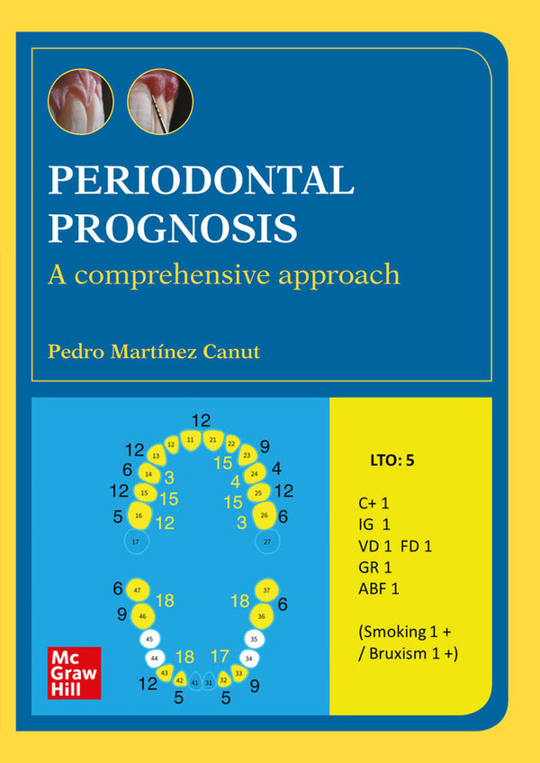 Periodontal Prognosis