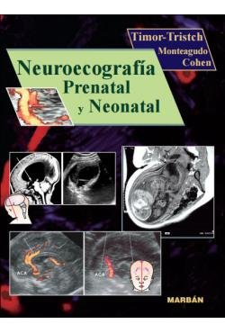 Neuroecografia Prenatal Y Neonatal