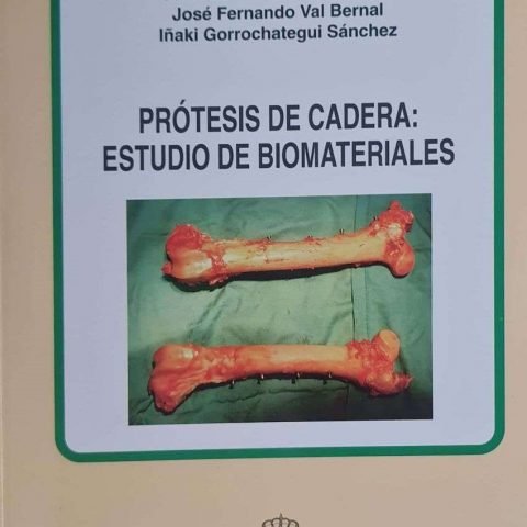 Protesis De Cadera Estudio De Biomaterial