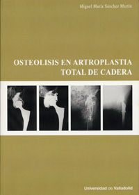 Osteolisis En Artroplastia Total De Cadera