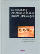 Integración De La Implantolog¡A En La Práctica Odontológica