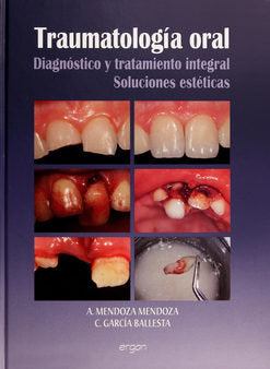 Traumatología Oral