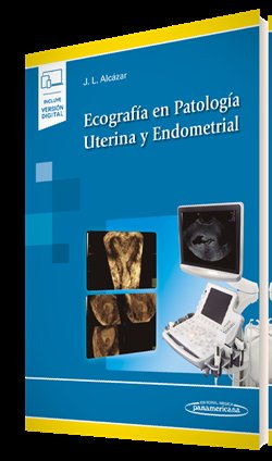 Ecografía En Patología Uterina Y Endometrial