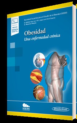 Obesidad