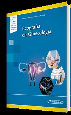 Ecografia En Ginecologia