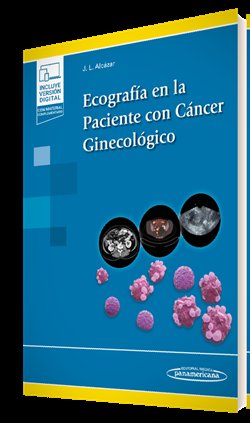 Ecografia En La Paciente Con Cancer Ginecologico