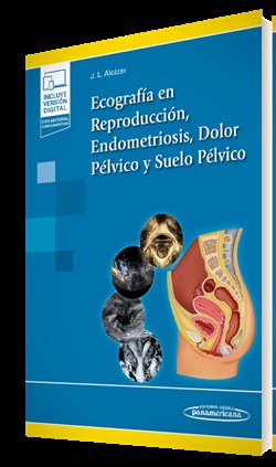 Ecografia En Reproduccion Endometriosis Dolor Pelvico Y Su