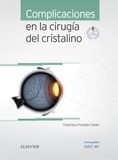 Complicaciones En La Cirugía Del Cristalino + Acceso Web