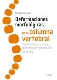 Deformaciones Morfológicas De La Columna Vertebral