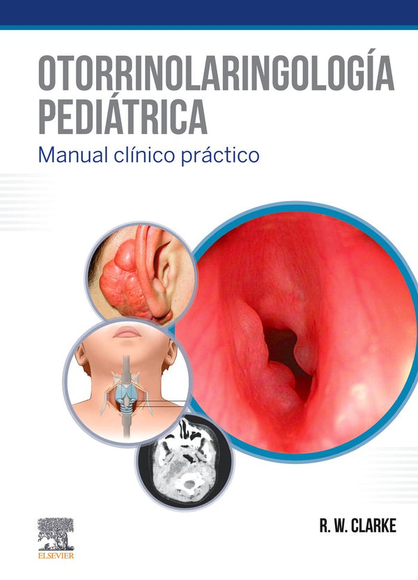 Otorrinolaringología Pediátrica