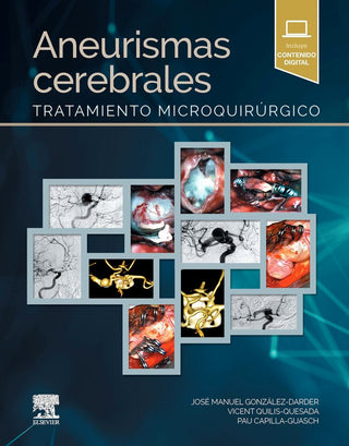 Aneurismas Cerebrales