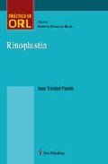 Rinoplastia