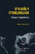 Otología Y Otoneurología