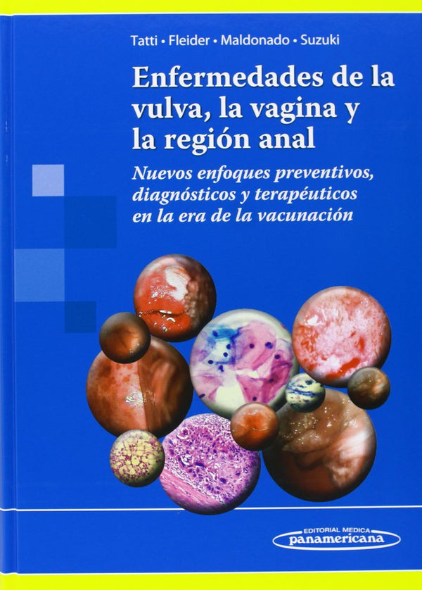 Tatti:Enfermedades De La Vulva