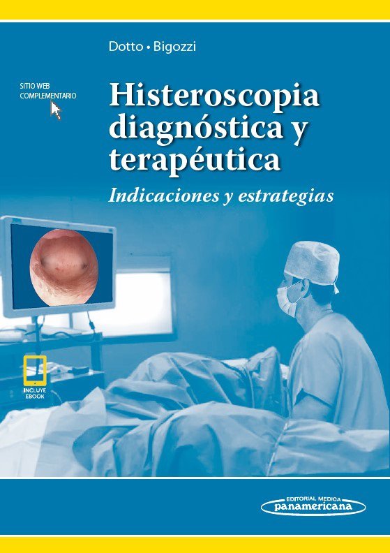 Histeroscopia Diagnóstica Y Terapéutica