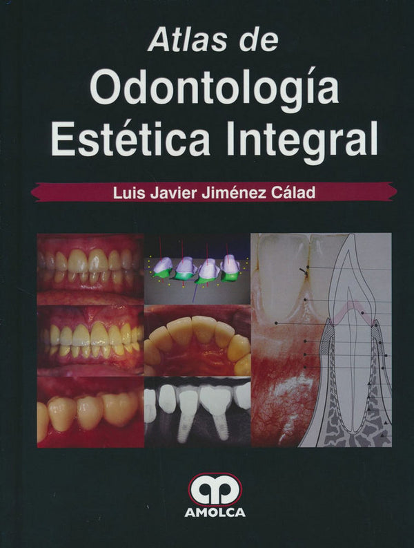 Atlas De Odontolog¡A Estética Integral