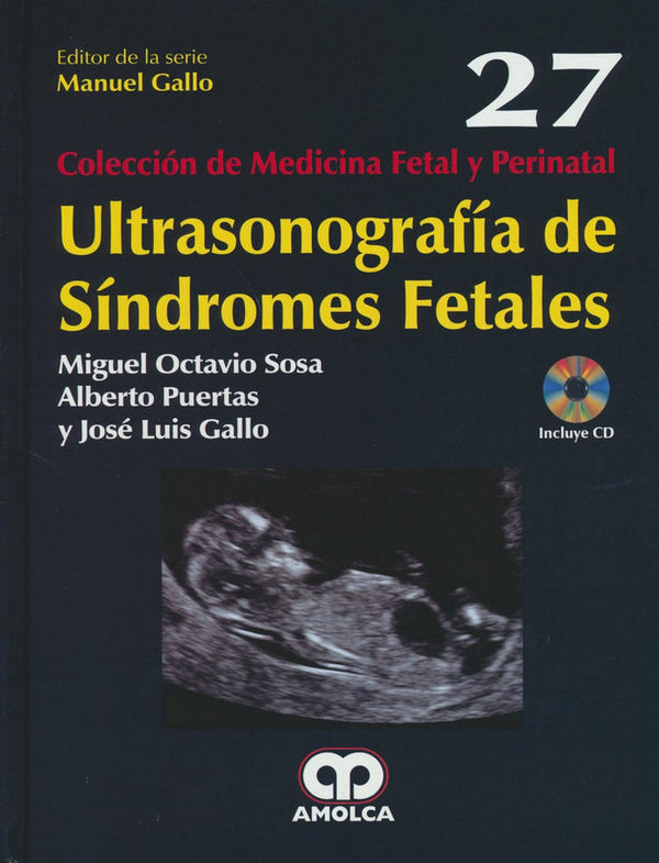 Ultrasonograf¡A De S¡Ndromes Fetales