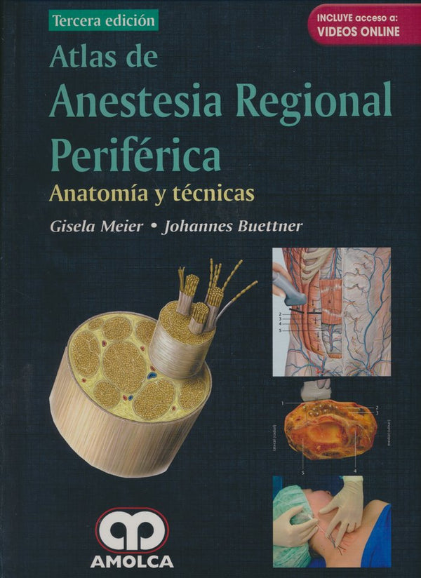 Atlas De Anestesia Regional Periferica