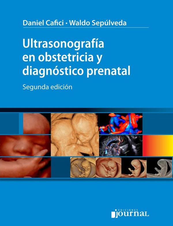 Ultrasonografia En Obstetricia Y Diagnostico Prenatal