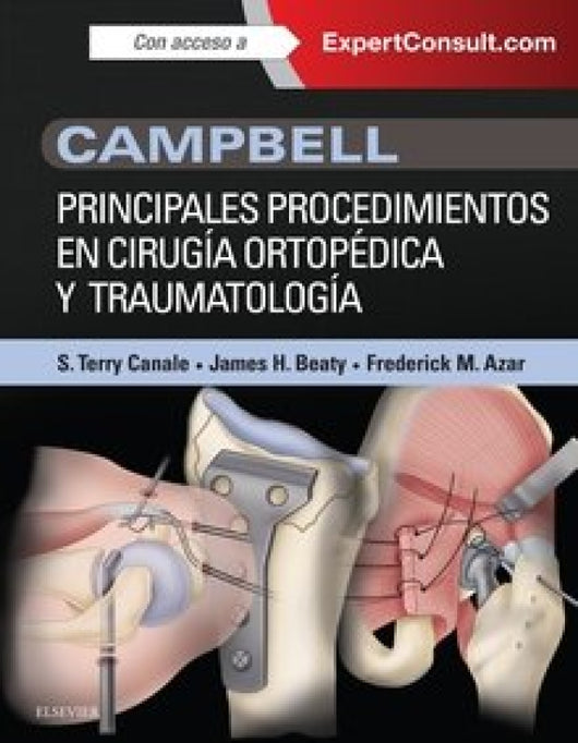 Campbell. Principales Procedimientos En Cirugía Ortopédica Y Traumatología + Expertconsult Libro