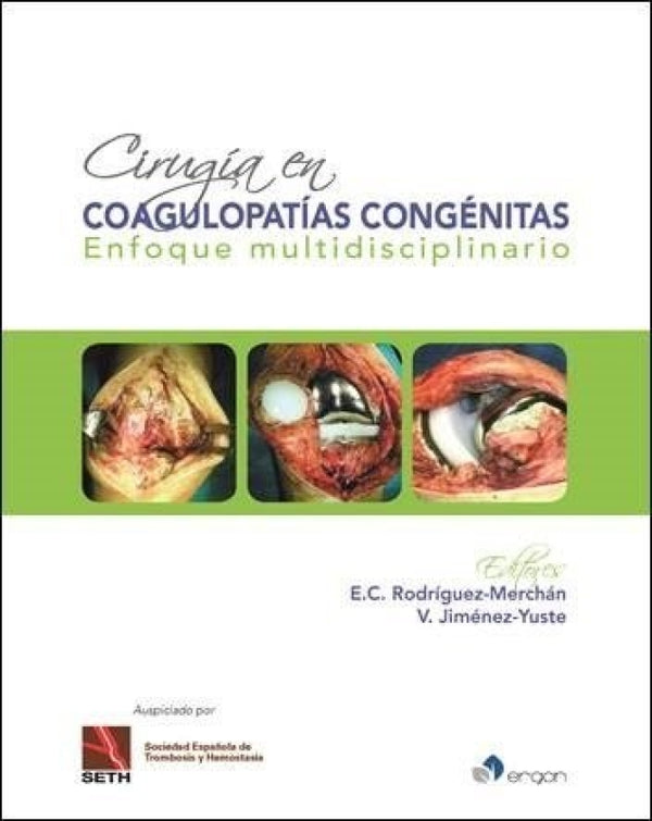 Cirugía En Coagulopatías Congénitas Libro