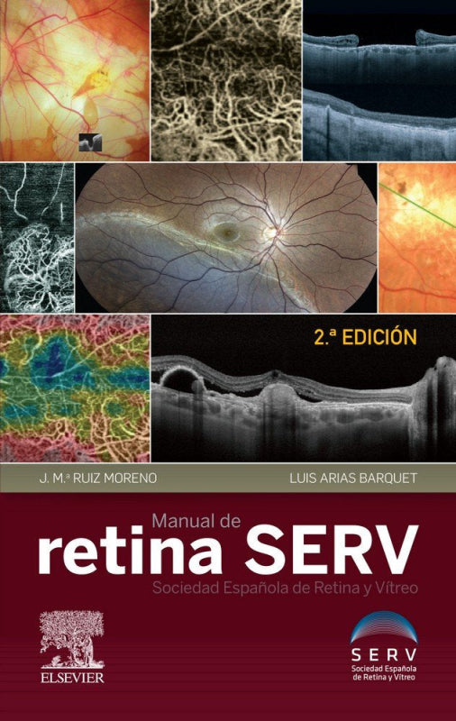 Manual De Retina Serv (2ª Ed.) Libro