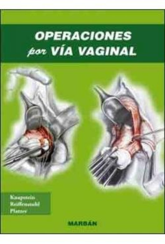 Operaciones Por V¡a Vaginal Libro