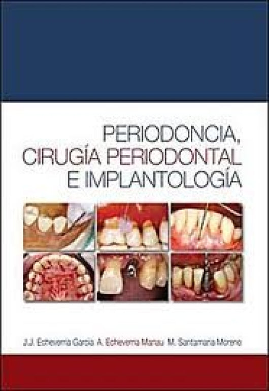 Periodoncia Cirug¡a Periodontal E Implantolog¡a Libro