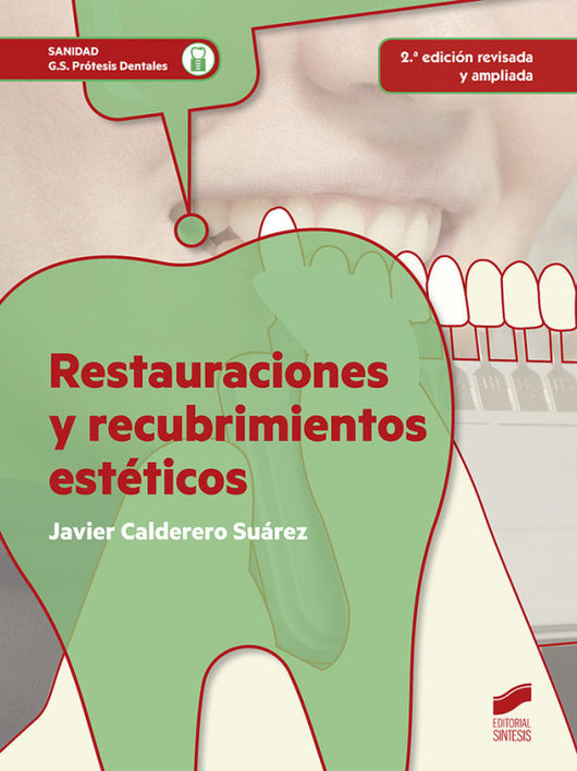 Restauraciones Y Recubrimientos Estéticos (2ª Edición Revisada Ampliada) Libro