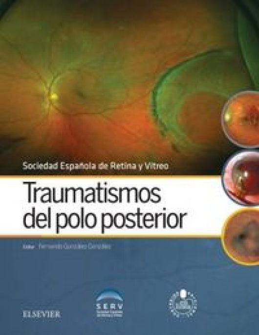 Traumatismos Del Polo Posterior + Acceso Web Libro